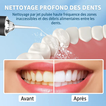 Nettoyeur Dentaire Pro - Votre Sourire Plus Sain au Quotidien